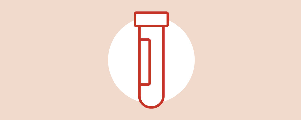 rotes Icon für 